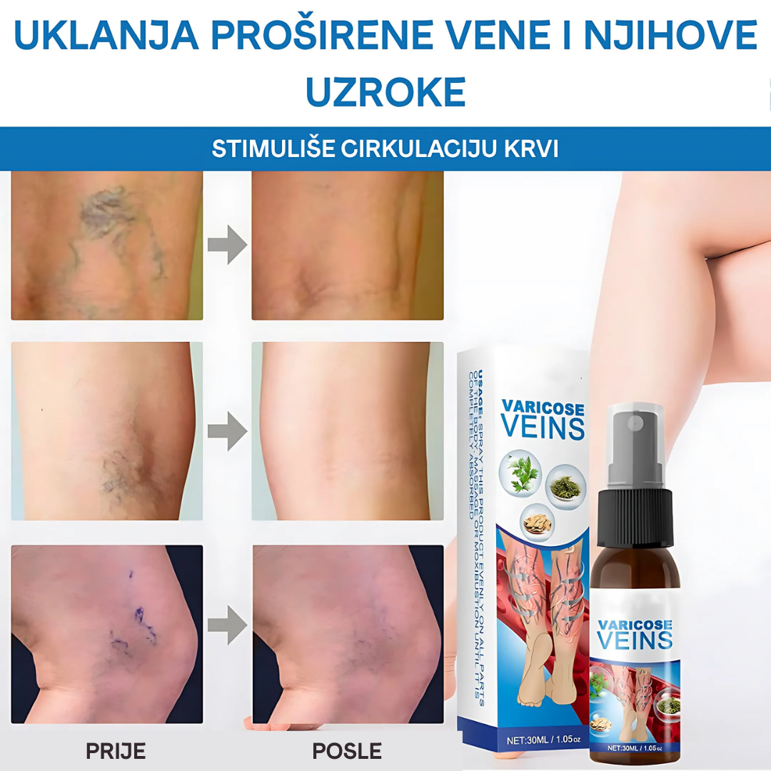 SPREJ ZA VENE